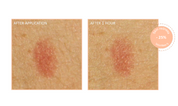 Skin Hero Serum