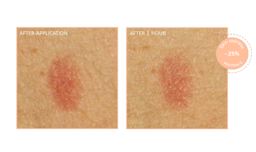 Skin Hero Serum