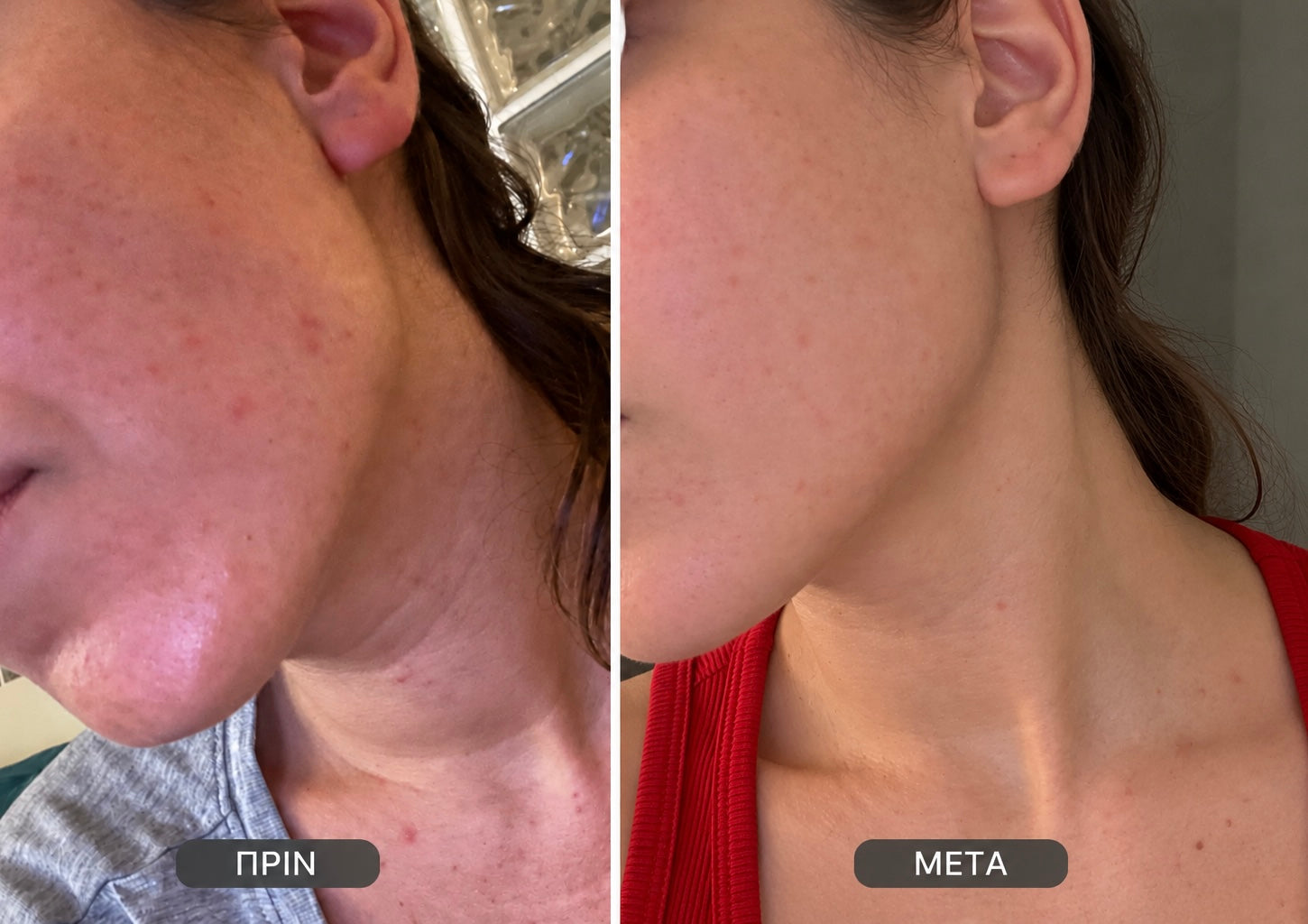 Skin Hero Serum