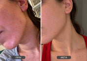 Skin Hero Serum