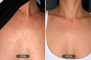 Skin Hero Serum